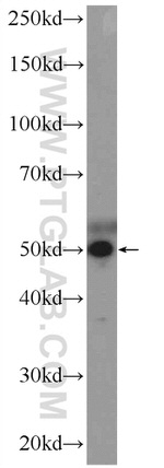 ZNF689 Antibody in Western Blot (WB)