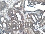 C2orf79/PTRHD1 Antibody in Immunohistochemistry (Paraffin) (IHC (P))