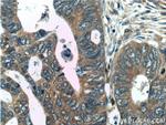 C2orf79/PTRHD1 Antibody in Immunohistochemistry (Paraffin) (IHC (P))