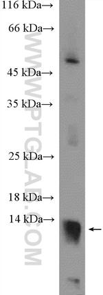 C2orf79/PTRHD1 Antibody in Western Blot (WB)