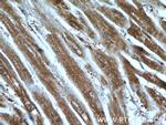 KBTBD10 Antibody in Immunohistochemistry (Paraffin) (IHC (P))