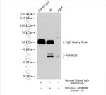 RPUSD1 Antibody in Immunoprecipitation (IP)