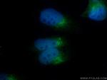 C13orf30 Antibody in Immunocytochemistry (ICC/IF)