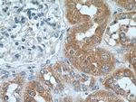 C13orf30 Antibody in Immunohistochemistry (Paraffin) (IHC (P))