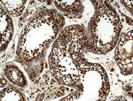 ZMYND12 Antibody in Immunohistochemistry (Paraffin) (IHC (P))