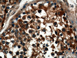 ZMYND12 Antibody in Immunohistochemistry (Paraffin) (IHC (P))