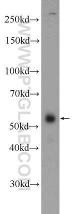 ZNF785 Antibody in Western Blot (WB)