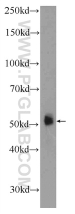 ZNF785 Antibody in Western Blot (WB)