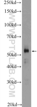ZNF785 Antibody in Western Blot (WB)