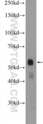 ZNF785 Antibody in Western Blot (WB)