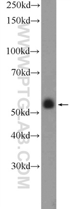 ZNF785 Antibody in Western Blot (WB)
