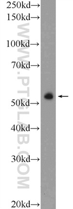 ZNF785 Antibody in Western Blot (WB)