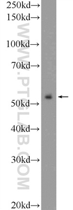 ZNF785 Antibody in Western Blot (WB)