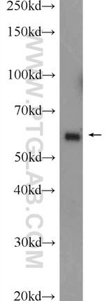 KLHL10 Antibody in Western Blot (WB)