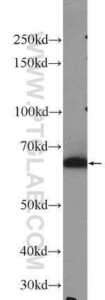 KLHL10 Antibody in Western Blot (WB)