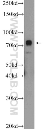 ZNF549 Antibody in Western Blot (WB)