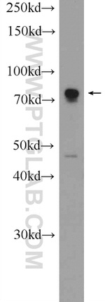 ZNF549 Antibody in Western Blot (WB)