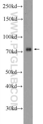 ZNF549 Antibody in Western Blot (WB)