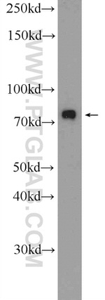 ZNF549 Antibody in Western Blot (WB)