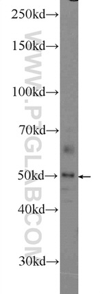 ZNF323 Antibody in Western Blot (WB)