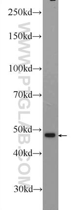 ZNF323 Antibody in Western Blot (WB)