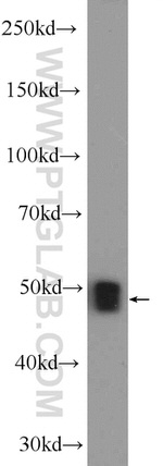 ZNF323 Antibody in Western Blot (WB)
