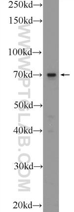TM9SF4 Antibody in Western Blot (WB)
