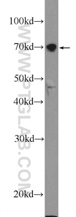 TM9SF4 Antibody in Western Blot (WB)