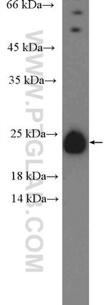 C6orf108 Antibody in Western Blot (WB)