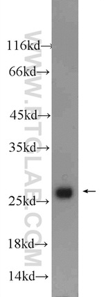 NFU1 Antibody in Western Blot (WB)