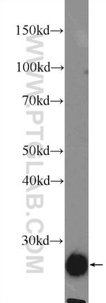 NFU1 Antibody in Western Blot (WB)