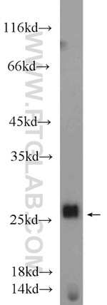 NFU1 Antibody in Western Blot (WB)