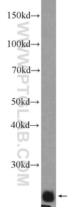 NFU1 Antibody in Western Blot (WB)