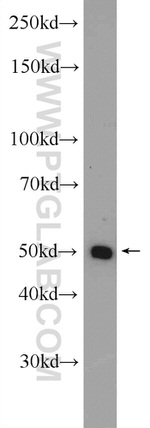 ZNF101 Antibody in Western Blot (WB)