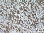 ZNF645 Antibody in Immunohistochemistry (Paraffin) (IHC (P))