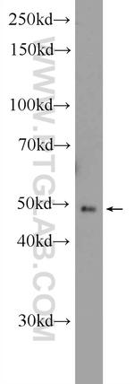 ZNF645 Antibody in Western Blot (WB)
