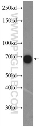 ZNF251 Antibody in Western Blot (WB)