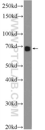 ZNF251 Antibody in Western Blot (WB)