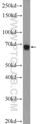 ZNF251 Antibody in Western Blot (WB)