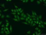 SUPT7L Antibody in Immunocytochemistry (ICC/IF)