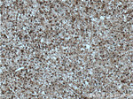 SUPT7L Antibody in Immunohistochemistry (Paraffin) (IHC (P))