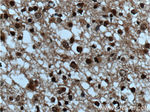 SUPT7L Antibody in Immunohistochemistry (Paraffin) (IHC (P))