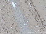 SUPT7L Antibody in Immunohistochemistry (Paraffin) (IHC (P))