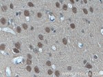 SUPT7L Antibody in Immunohistochemistry (Paraffin) (IHC (P))