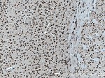SUPT7L Antibody in Immunohistochemistry (Paraffin) (IHC (P))