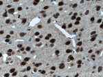 SUPT7L Antibody in Immunohistochemistry (Paraffin) (IHC (P))