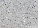 SUPT7L Antibody in Immunohistochemistry (Paraffin) (IHC (P))