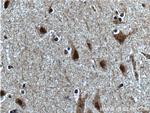 SUPT7L Antibody in Immunohistochemistry (Paraffin) (IHC (P))