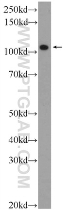 FSD2 Antibody in Western Blot (WB)