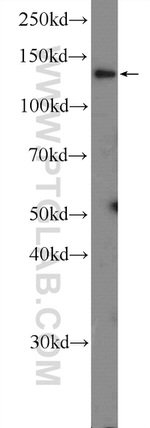 CEBPZ Antibody in Western Blot (WB)